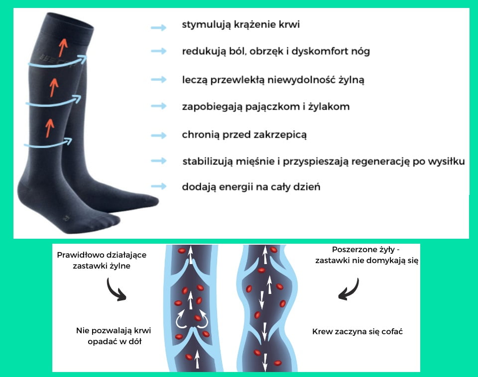 podkolanówki na żylaki pończochy pooperacyjne na obrzęki